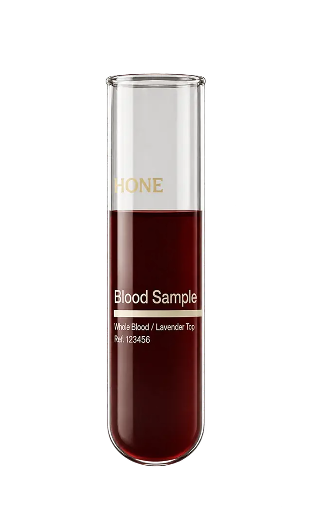 Hone blood sample tube